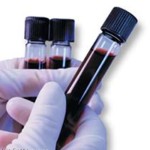 Limit on DUI Blood Testing
